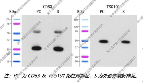 umibio®外泌体CD63&TSG101蛋白检测试剂盒 适用外泌体蛋白检测WB