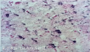 百代BIOG地高辛标记原位杂交检测试剂盒有效封闭核酸探针结合位点