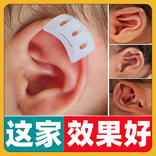 【效果太好了】宝宝耳朵纠正器