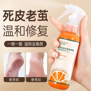 去死皮老茧去脚后跟老茧粗糙润滑足部去角质喷雾水嫩清洁死皮男女