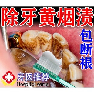 强力去烟渍牙膏去牙渍牙垢黄牙结石牙齿茶渍茶牙克星速效清除神器