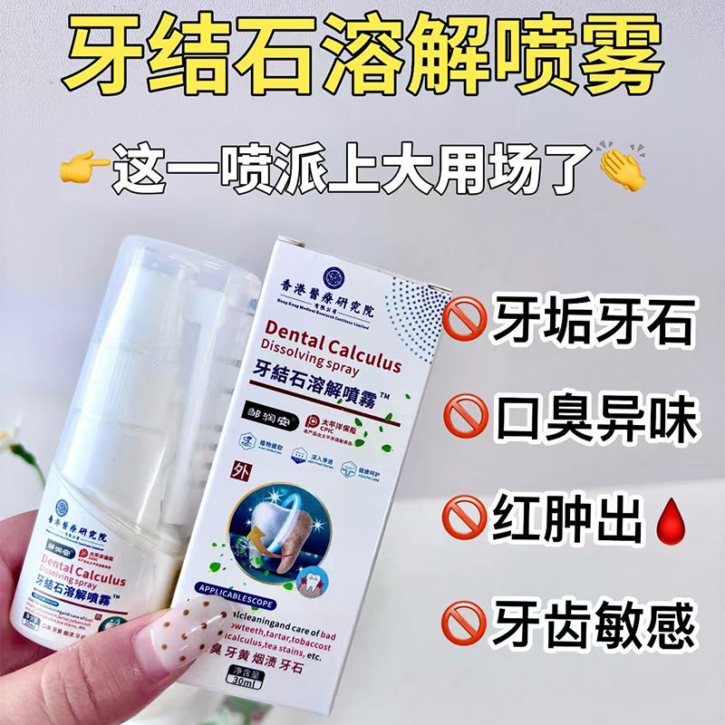 牙结石去除器溶解除牙石速效喷雾剂洗牙齿牙垢污垢牙黄清除神器牙