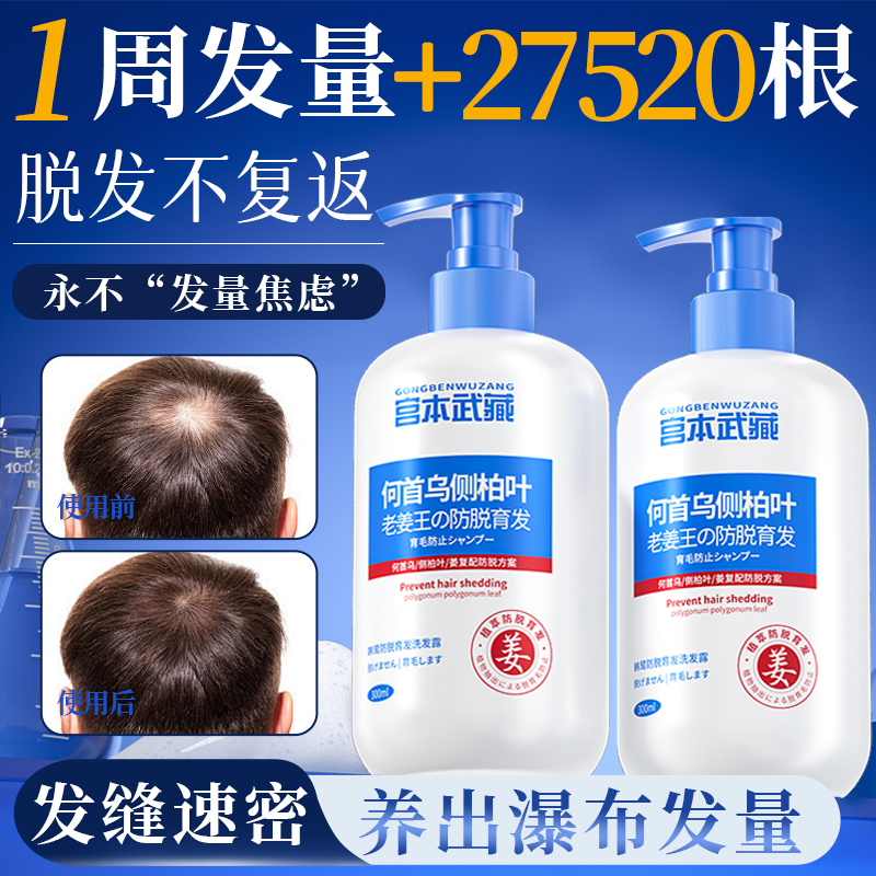 侧柏叶防脱生发固守发际线