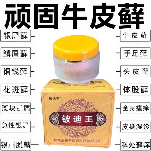 牛皮藓症病腿上起干皮专用红斑治鲜药正品杀菌皮肤外用乳膏