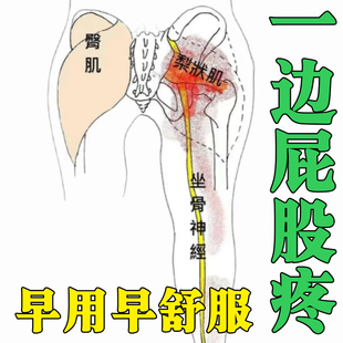 梨状肌综合症特效膏药痛神经坐骨腿麻屁股疼药椎腰压迫专用膏药贴