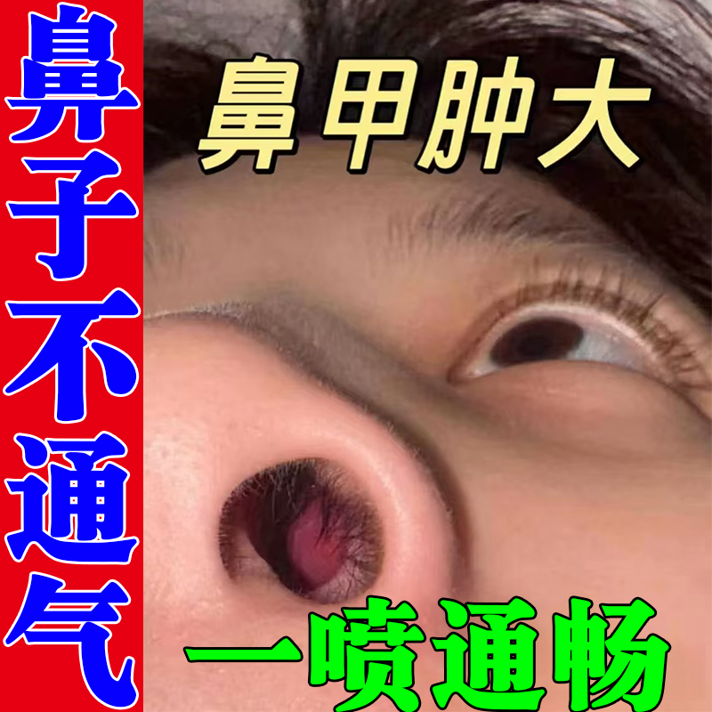嗅觉失灵闻不到鼻塞鼻痒流涕鼻息肉鼻甲肥大喷雾剂鼻子不通气神器