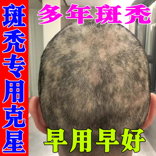 斑秃特效鬼剃头药防脱发克星专用喷剂一抹灵生姜液遮盖神器
