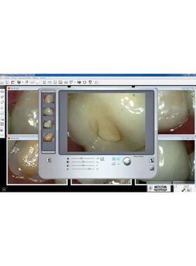 KODAK Dental Imaging Software