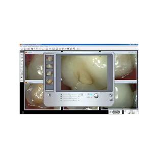 KODAK Dental Imaging Software