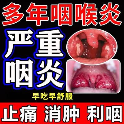 复方鱼腥草片咽喉疼痛急性咽炎扁桃腺炎专用非特效的药鱼腥草颗粒