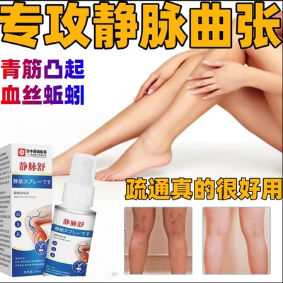 静脉曲张蚯蚓腿喷雾剂