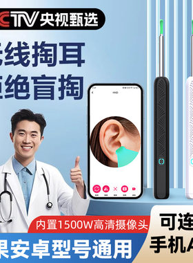 可视化掏耳勺高清医用掏耳神器带灯发光高清采耳儿童专用工具套装
