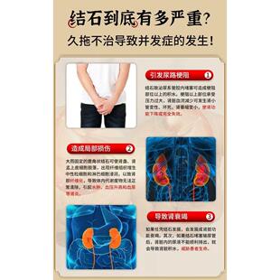李时珍500粒体内金结菊苣内结石WVP石鸡排尿堵塞尿石胆石提取