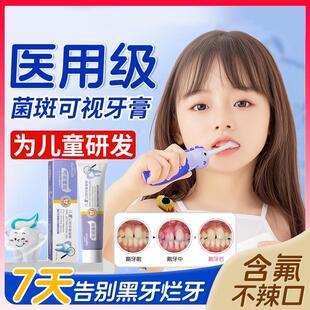 儿童牙菌斑可视牙膏显色去黑牙显示剂3-12岁以上含氟防蛀固齿着色