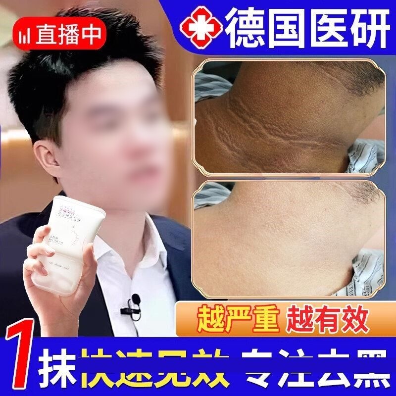 脖子黑色素去除黑棘皮脖子黑色素沉淀洗不乾净肥胖儿童美白神器