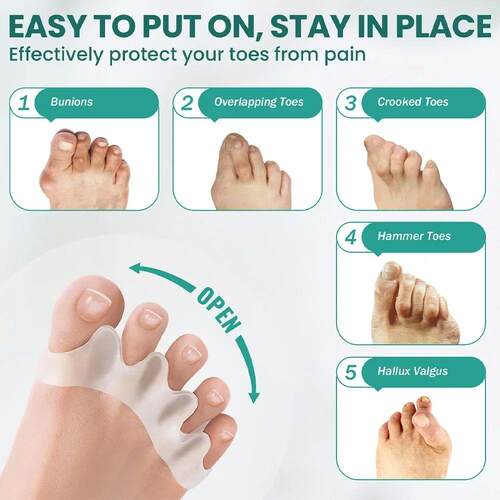 1 Pair Silicone Toe Separator Bunion Corrector Hammer Toe Co