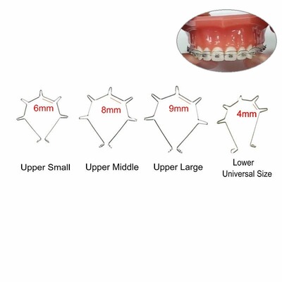 正畸转矩簧五曲簧牙科材料