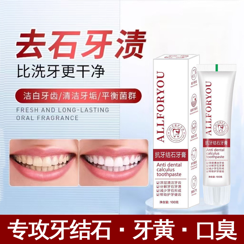 【爆款甄选】牙结石去除器美白去漱口水