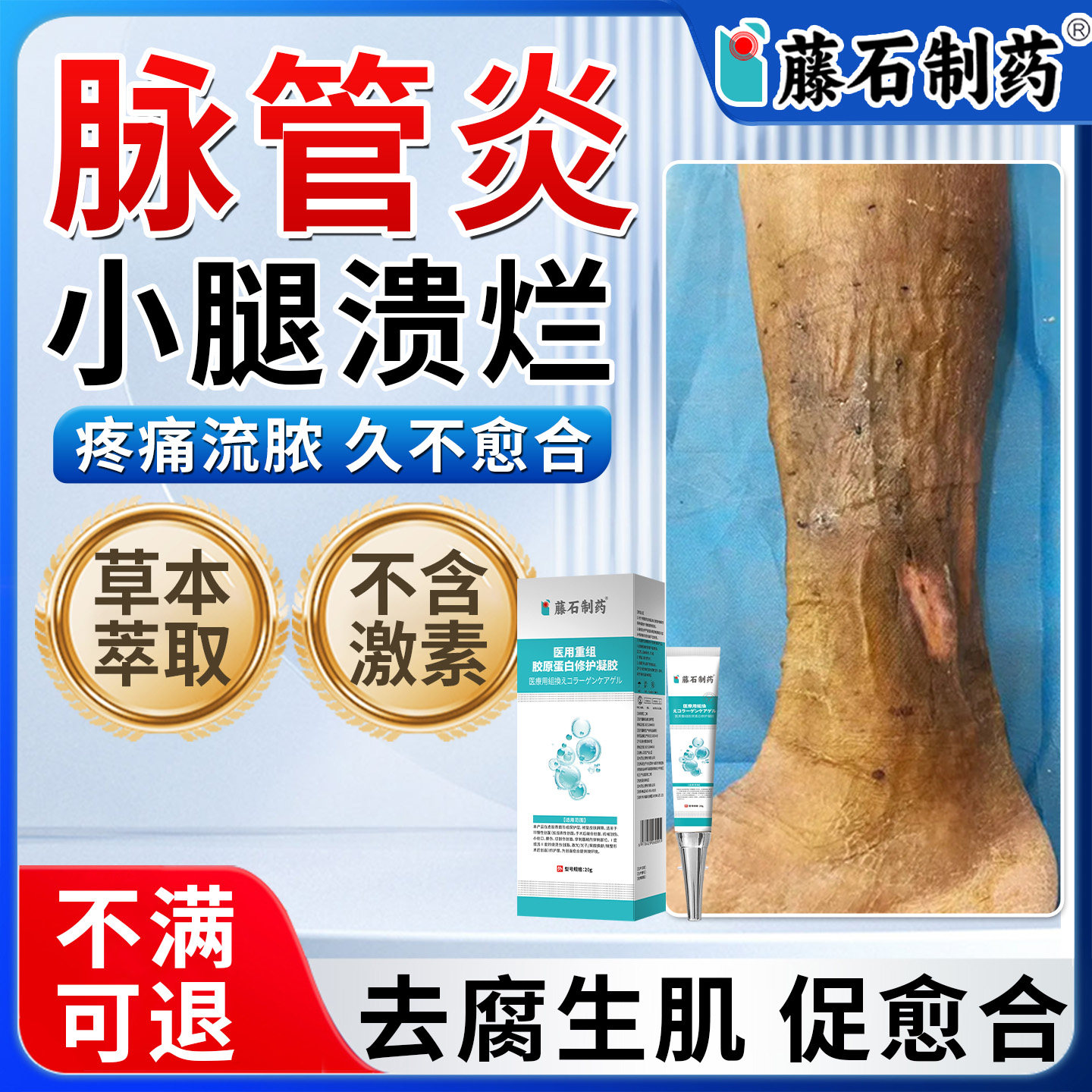 脉管炎老烂腿专去腐生肌膏用创伤口小腿下肢静脉溃烂发黑药膏xu