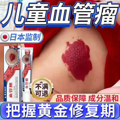 【儿童可用】血管瘤血痣膏