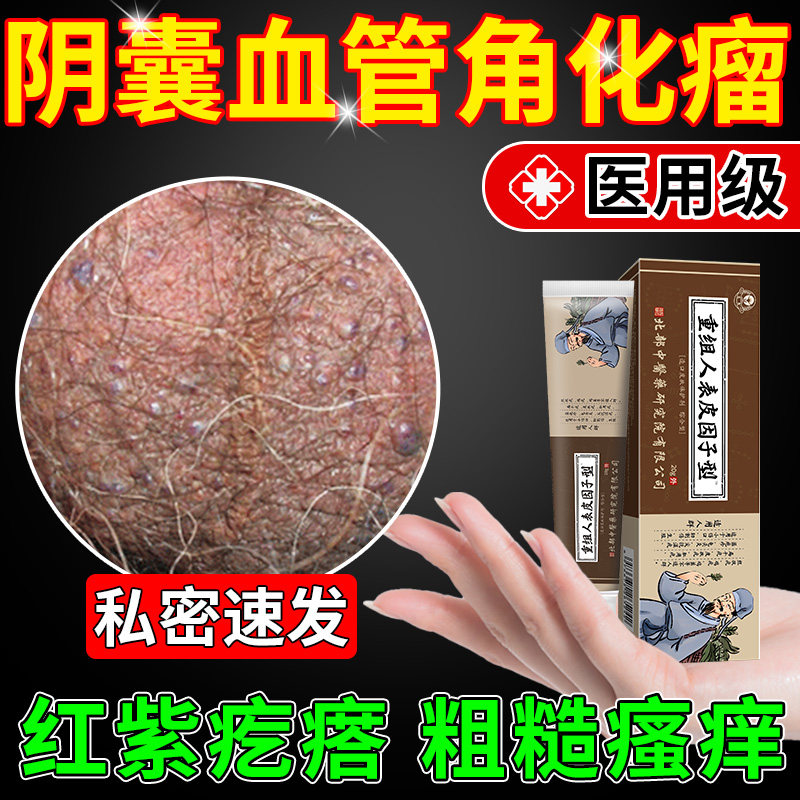 阴囊血管角化瘤蜘蛛痣血管痣红黑疙瘩精索曲张丘疹肿块触痛瘙痒k3