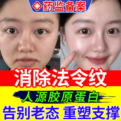 淡化法令纹医用重组人源化胶原蛋白敷料活细胞填充面部修复凝胶xu