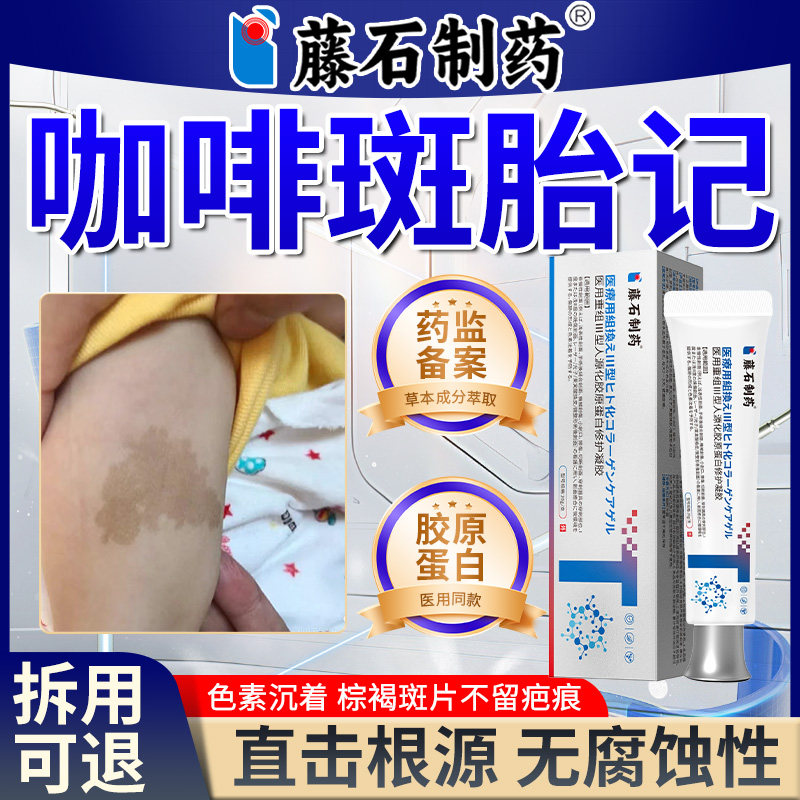 咖啡斑胎记去除儿童胎记牛奶斑神经性纤维瘤医用重组胶原蛋白贴xu