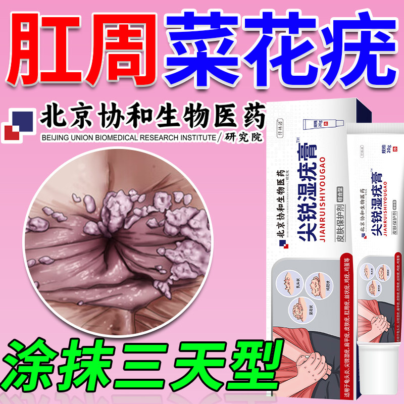男性肛门尖锐湿疣私处生殖器专用膏菜花状疣hpv去疣鬼舀毒素酊le