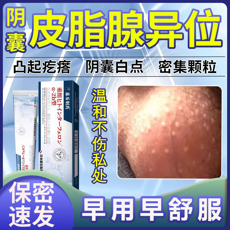 阴囊小疙瘩皮脂腺异位症包皮蛋皮上白点潮湿疹瘙痒非膏药贴pr