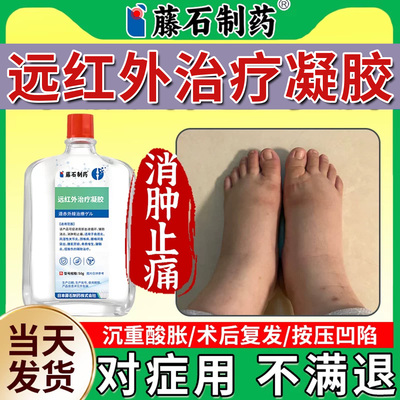 藤石制药下肢淋巴水肿治疗小腿脚踝按压凹陷走路苦难腿部发肿xu