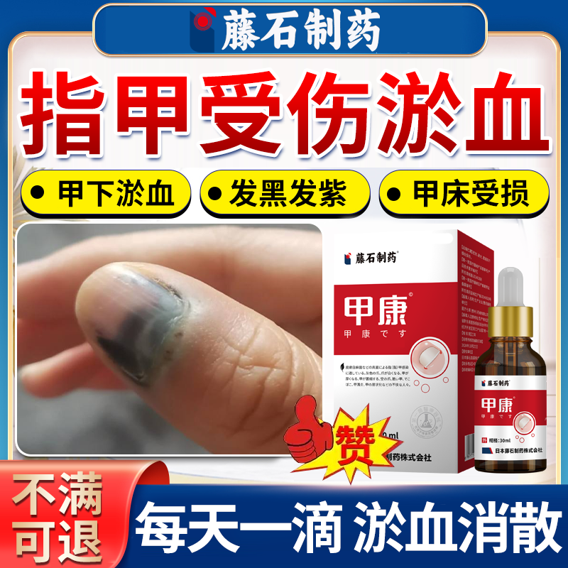 指甲有淤血】指甲护理液擦剂