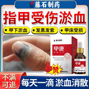 甲下脚趾甲指甲脚指甲脚趾被砸被夹淤血瘀血指甲内盖出血修复液OZ