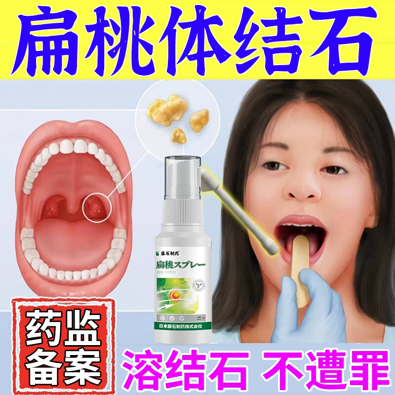 去扁桃体结石专用去除喉咙发炎工具神器药房款医用级溶解喷雾剂DZ