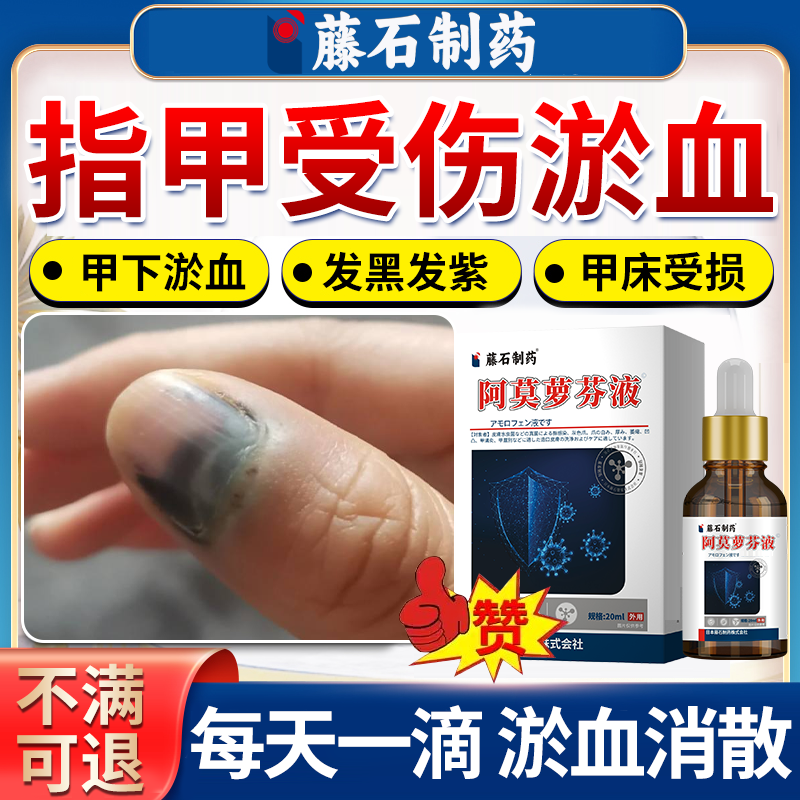 指甲有淤血】指甲护理液擦剂