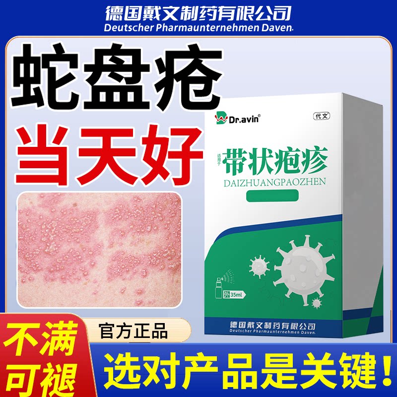 蛇盘疮烟袋油带状疱i疹后遗症神经痛疼皮肤瘙i痒效专特外用药WT