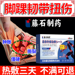 前距腓韧带损伤韧带撕裂可搭膏药脚踝跌打损伤伤筋动骨活血化瘀CS