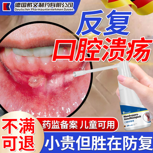 反复口腔溃疡喷雾剂特儿童效舌头溃疡口腔黏膜修复液药监备凝胶SE