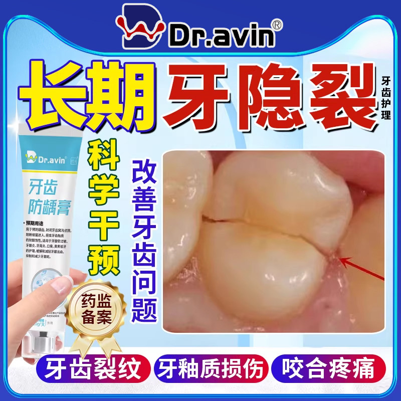 牙隐裂牙齿裂纹牙釉质裂缝修补楔状缺损修补龋齿修复液非牙膏LJ
