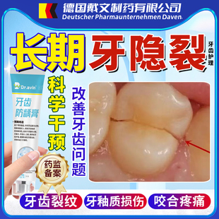 牙隐裂牙齿裂纹牙釉质裂缝修补楔状缺损修补龋齿修复液非牙膏LJ