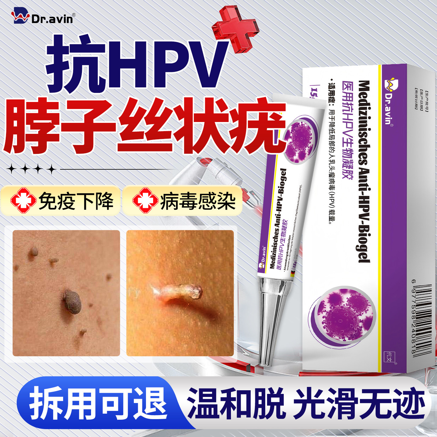 脖子上长小肉粒疙瘩丝状疣医用祛疣瘊扁平疣去神器去除药膏皮赘QQ