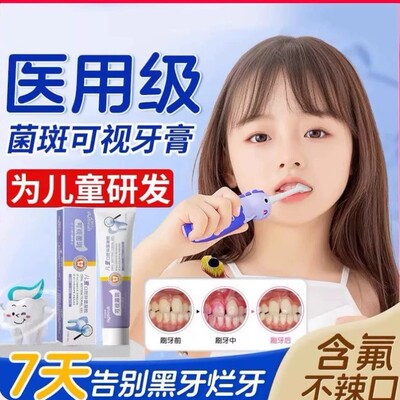 儿童牙菌斑可视牙膏显色去黑牙显示剂3-12岁以上含氟防蛀固齿着色