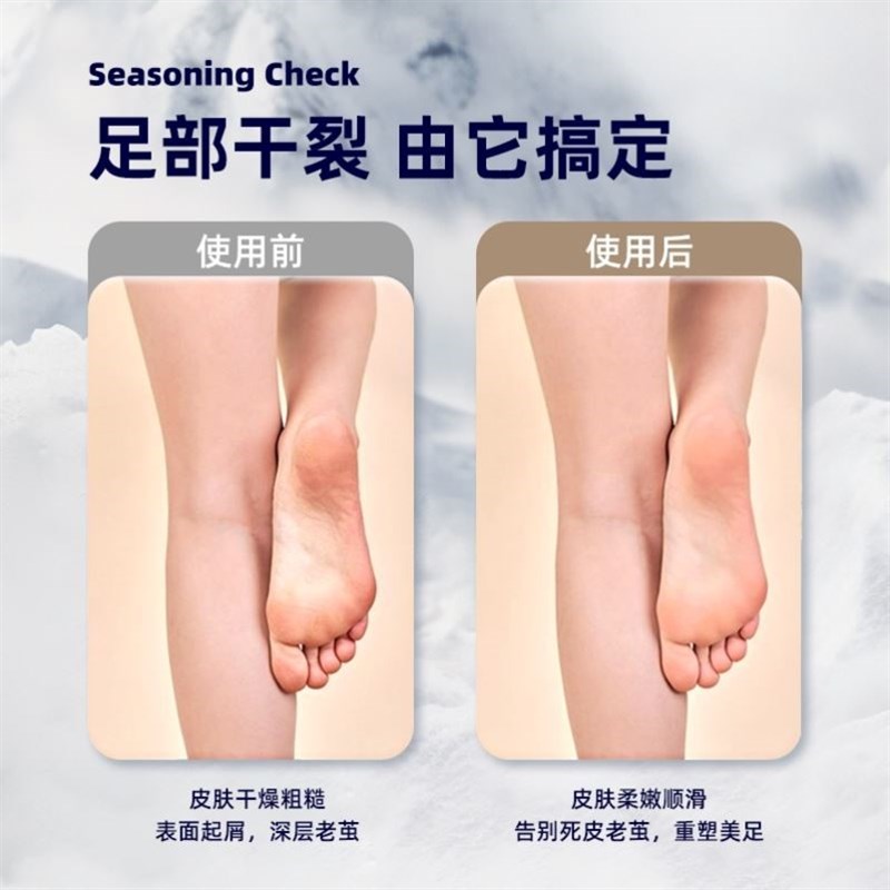 电动磨脚器修脚神器去脚皮老茧死皮全自动修足机充电脚石打磨机