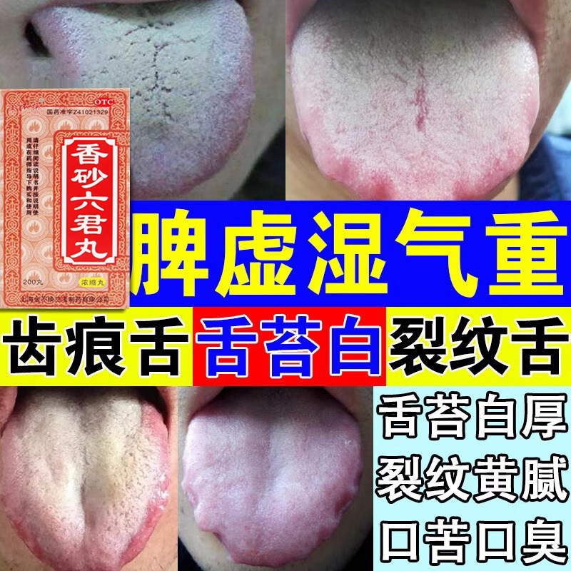 香砂六君子丸正品浓缩丸祛湿健脾胃去湿气重排毒减肥调理正品官方