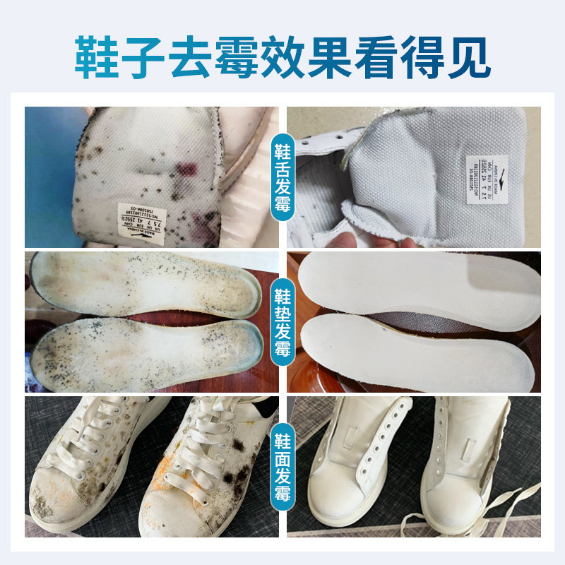 鞋子发霉去霉剂去球鞋霉点清除网面霉斑霉菌白鞋祛霉除霉清洁皮鞋