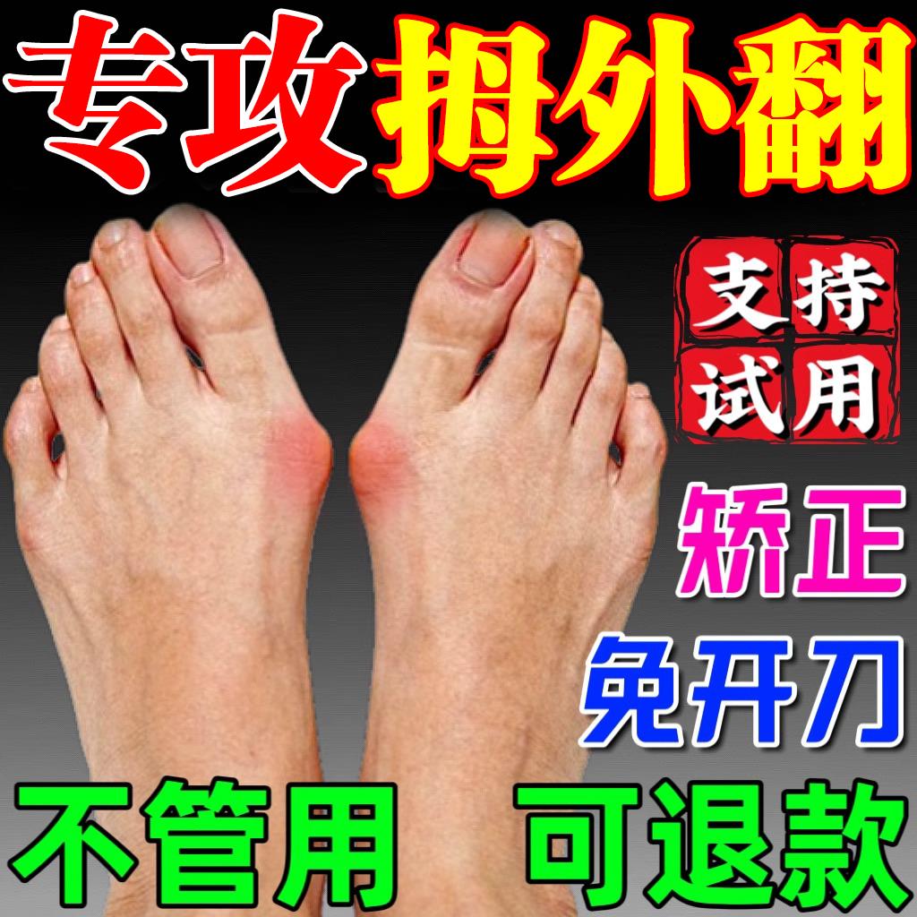 拇指外翻药膏贴关节畸形外翻脚趾变形拇指矫正器肌贴拇外翻矫正贴