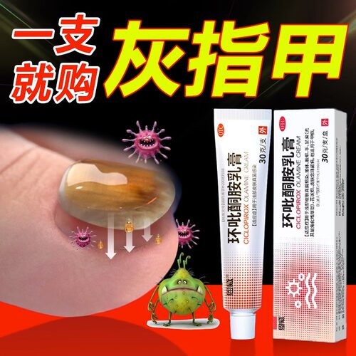 【恩威】环吡酮胺乳膏1%*30g*1支/盒足癣灰指甲真菌感染杀菌体癣