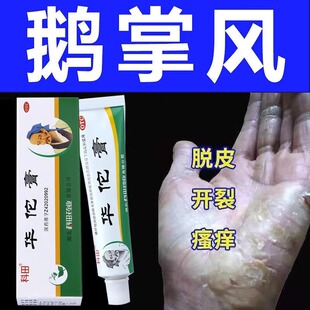 包邮】科田华佗膏20g杀菌止痒脚趾痒鹅掌风脚气药癣正品华陀膏ZZ