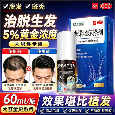 芙蓉堂米诺地尔搽剂官方旗舰店斑秃生发液男士脱发防脱发生发剂