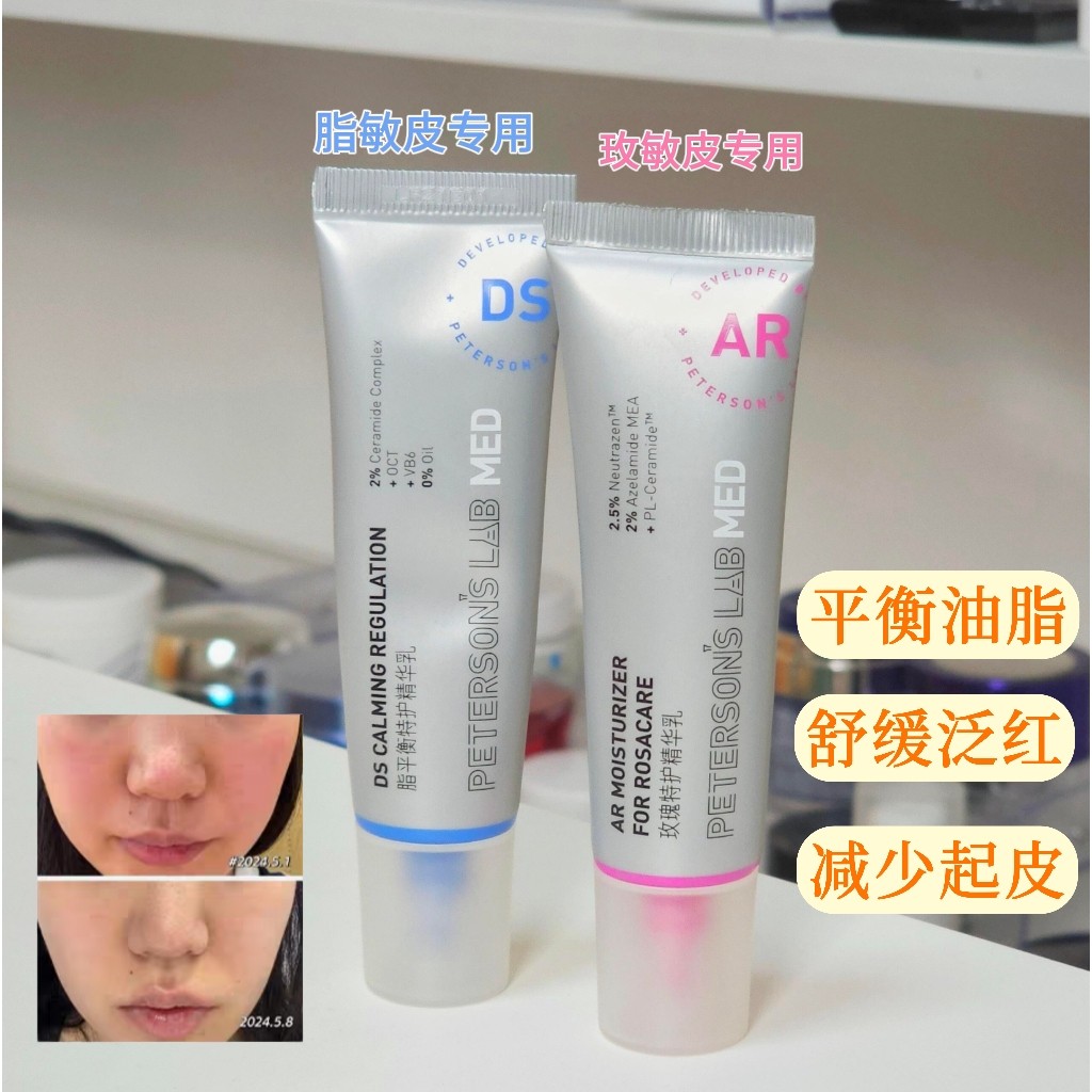 毕生之研AR乳DS乳玫瑰痤疮脂溢性