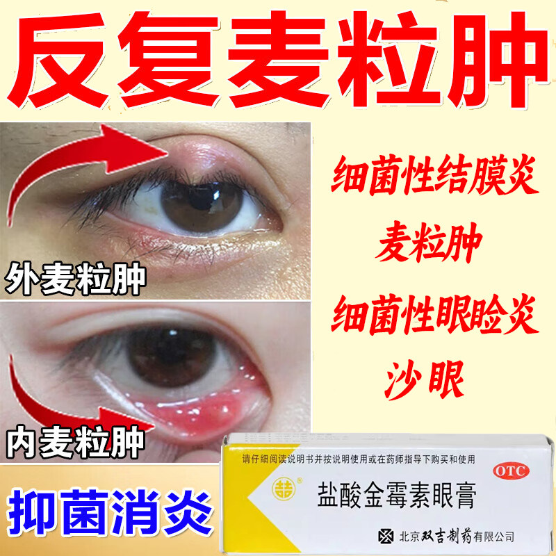 【双吉】盐酸金霉素眼膏0.5%*2.5g*1支/盒麦粒肿沙眼结膜炎眼睑炎